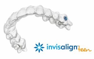 invisalign teen