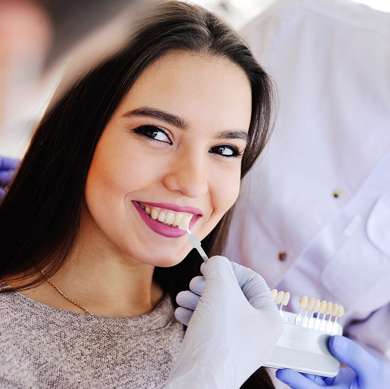 Dental Veneers