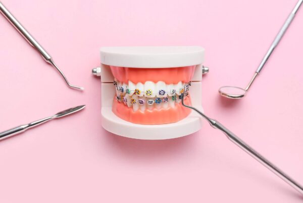 Cleaning your braces at home, water floss, Invisalign, fluoride toothpaste, electric toothbrush, blog for Sheman Dental